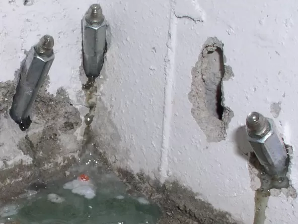 Intervento con packer in acciaio